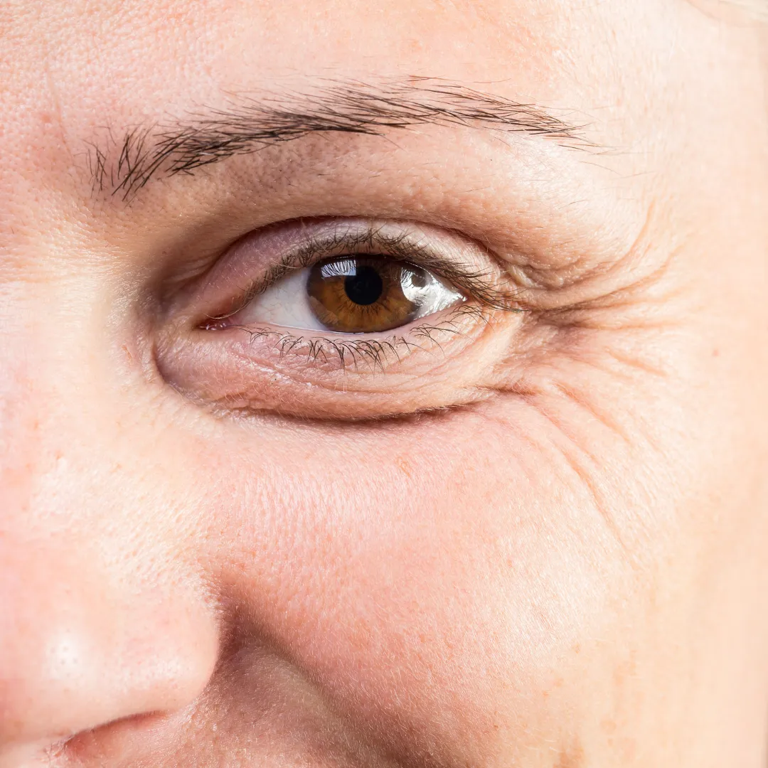 ojo seco en la vejez